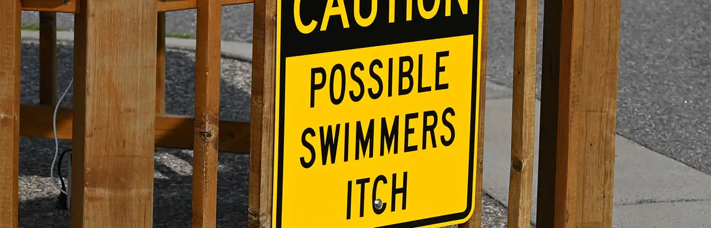 Swimmers Itch